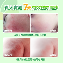 Load image into Gallery viewer, 日本Healthive|天然抗敏消紅止癢多用途消炎修護母嬰級皮膚凝膠|港澳總代
